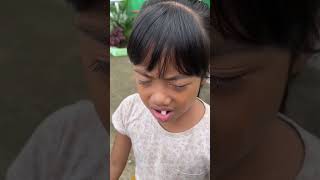 Syakia Berani Cabut Gigi