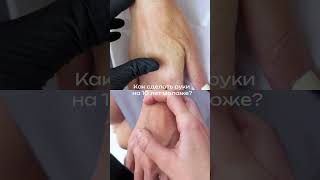 Полимолочная кислота (руки)