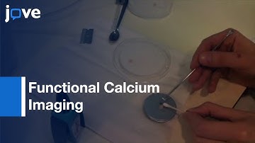Functional Calcium Imaging In Developing Cortical Networks l Protocol Preview