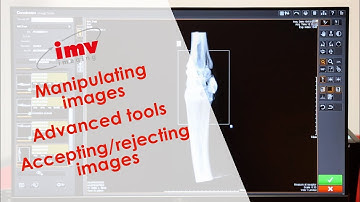 Carestream Image Suite: Manipulating images - Advanced tools - video 3