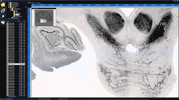 BigBrain Viewer 2D Image Tutorial