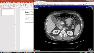 Insert Scrolling images from ClariPACS to your Powerpoint presentation