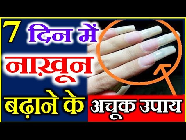 ऐसे पहचाने नाखून की चोट और अपनाए ये घरेलू उपचार | NewsTrack Hindi 1