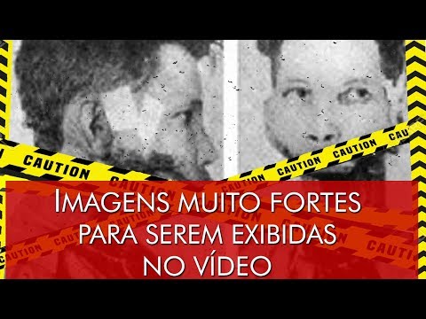 Vídeo: 6 Fatos Assustadores Sobre Doenças Priônicas Misteriosas E Mortais