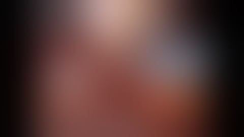 Robotic Cholecystectomy with Cholangiogram