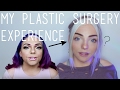 My Facial Reconstruction | Stef Sanjati