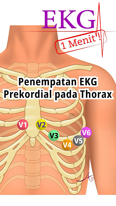 EKG 1 Menit: Penempatan EKG Prekordial pada Thorax