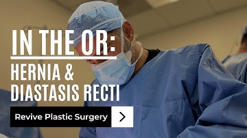 Plastic Surgery: Fixing a Hernia & Diastasis Recti