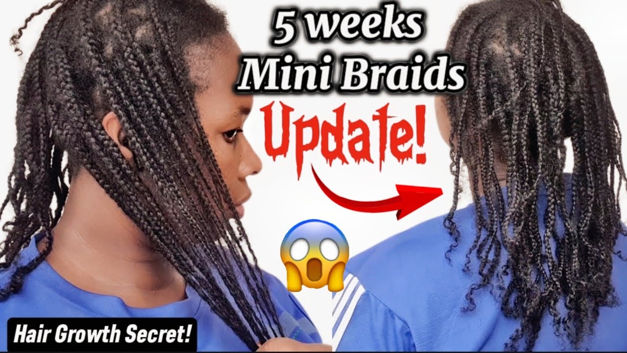 Still struggling with hair growth? here is what you can do|| 3 Months Mini Braids Challenge update!