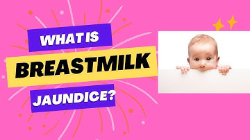 Penyakit kuning akibat ASI l Penyakit kuning akibat menyusui #penyakit kuning neonatal