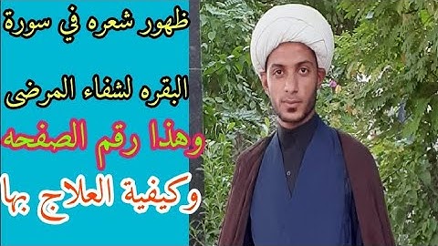 ظهور شعره في سورة البقره وكيفية العلاج بها