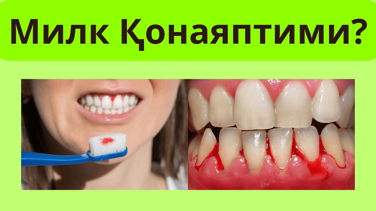 Пародонтоз ва Диабет! Диабет ва Пародонтоз