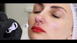 картинка: Видео. Мастер-класс Елены Байбариной. Коррекция формы носа.