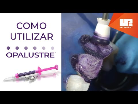 Vídeo: Como usar pasta química?