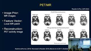 Bridging Physics and Learning: a decade of kernel methods for image reconstruction, Guobao Wang PhD