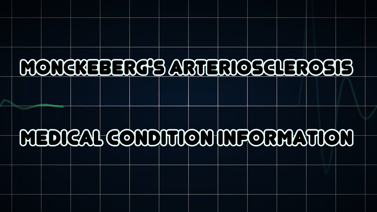 monckeberg-s-arteriosclerosis-medical-condition-youtube