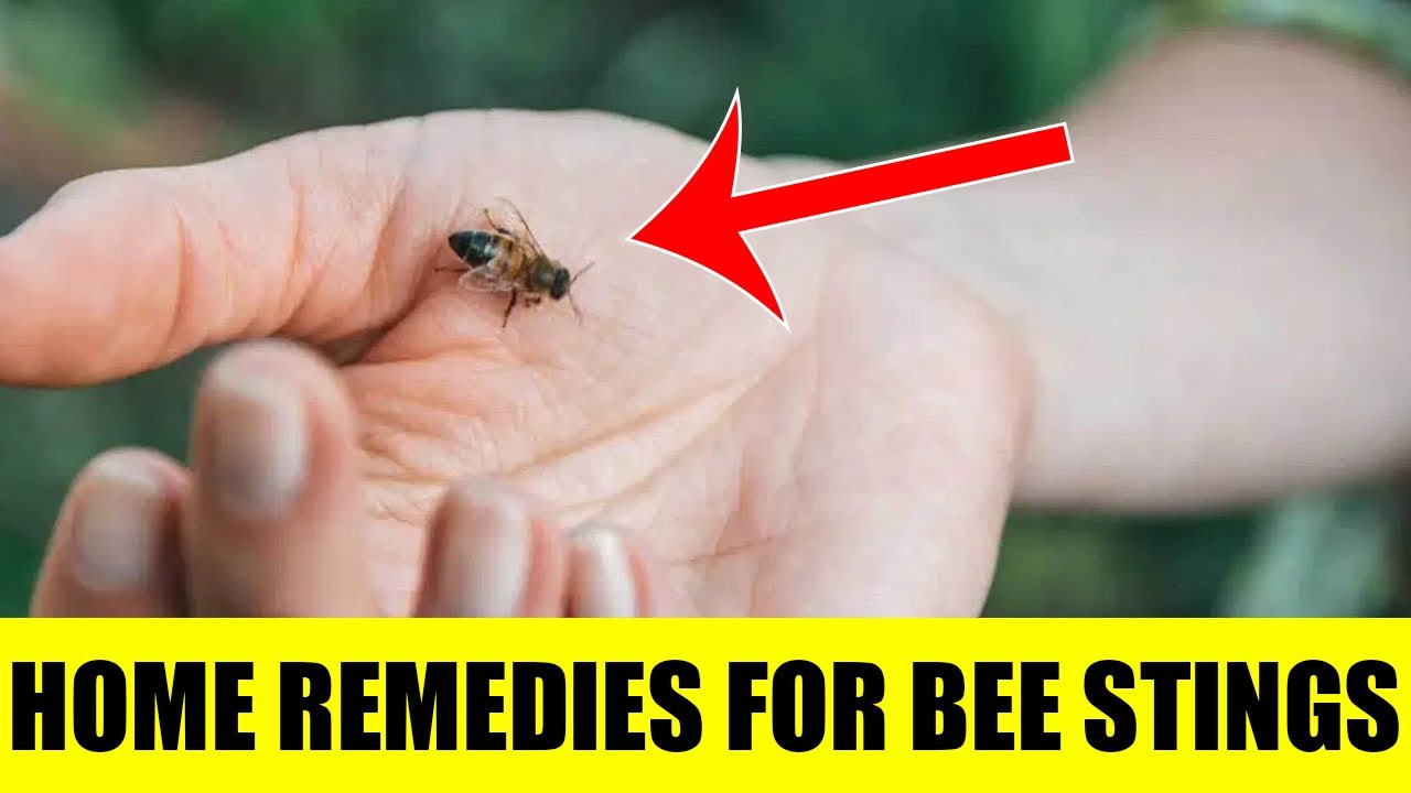 Bee Stings Home Remedies For Bee Stings Home Remedy For Wasp Sting Youtube