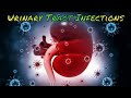 Renal and Urinary Tract Infections (updated 2023) - CRASH! Medical Review Series