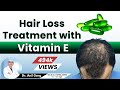 Hair loss Treatment with Vitamin E | बालो के लिए घरेलु उपचार | Dr. Anil Garg