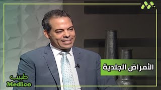 الأمراض الجلدية الشائع انتشارها في فصل الصيف وأهمهم حب الشباب الأسباب وطرق العلاج مع د. ماهر محمود