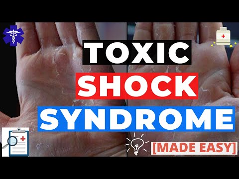 Video: Toxic Shock Syndrome: Symptomen, Diagnose En Behandeling