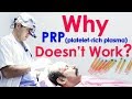 Why PRP doesn't work Explained by Dr Suneet at Medispa Hair Transplant India