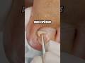 Satisfátório é ver isso sair #satisfying