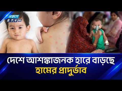 ২৪ ঘণ্টায় হাম ও উপসর্গ নিয়ে আরও ৭ জনের মৃ/ত্যু | Measles | Ekushey TV