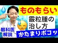 【ものもらい】霰粒腫（さんりゅうしゅ）の治し方！（痛くない塊）眼科医が解説！