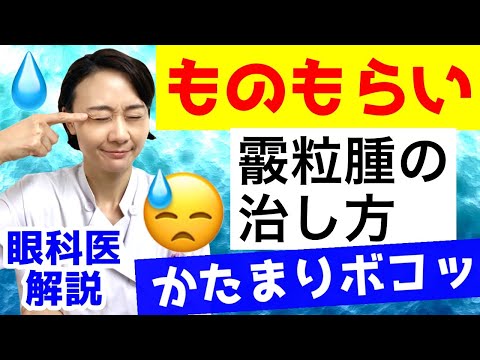 【ものもらい】霰粒腫（さんりゅうしゅ）の治し方！（痛くない塊）眼科医が解説！