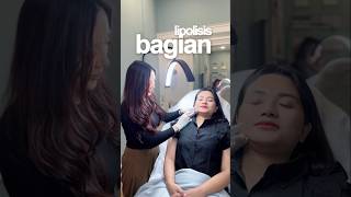 #aesthetic #antiaging #giarmi #kecantikan #pekanbaru
