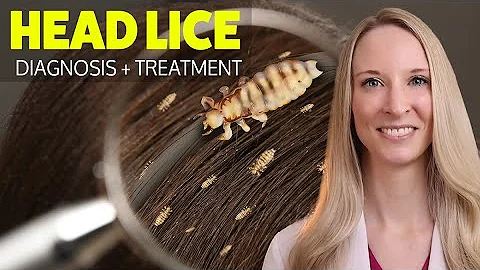 HEAD LICE: Diagnosis, Treatment, Home Remedies, Tips from a dermatologist for self treatment