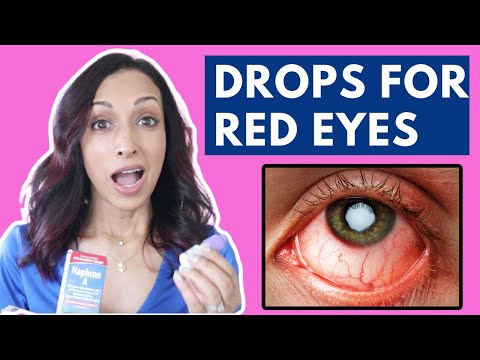 Red eyes? See an optometrist!
