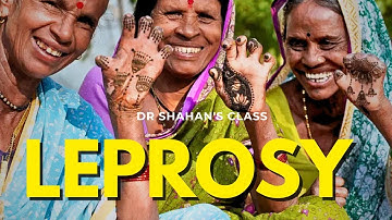 Leprosy #doctor #medical #Neetpg #FMGE 