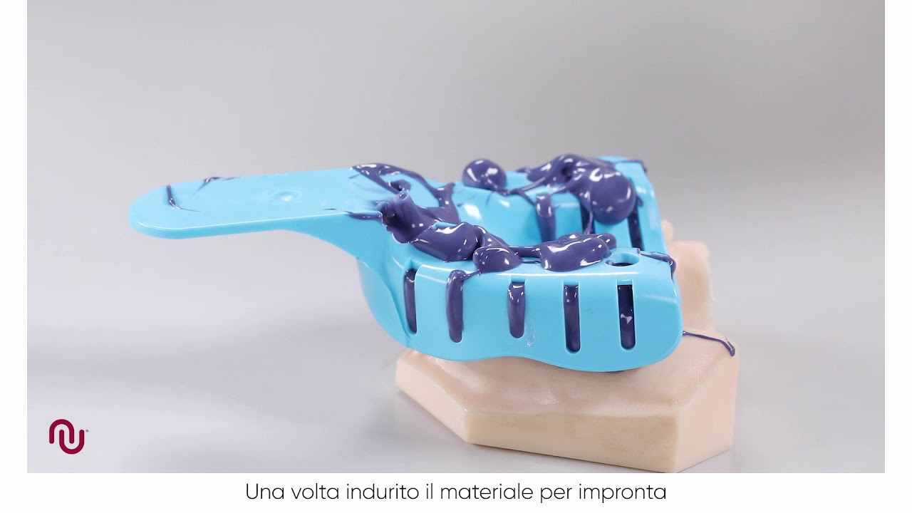 Transfer da Impronta Neoss aperto