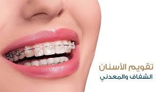 تقويم الأسنان: تحسين صحة وجمال الابتسامة