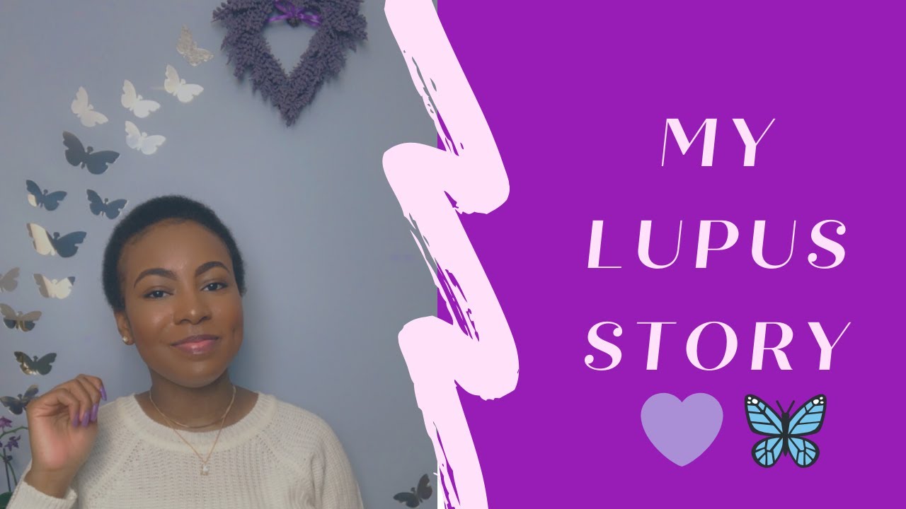 STORY TIME: How I found out I had LUPUS