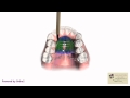 Pendulum appliance  wellington village orthodontics