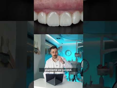 VAKA – 10 Üyeli Kompozit Lamine: Kırıklardan ve Çapraşıklıktan Özgürleşen Gülüş