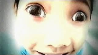 FIBISCO-HIRO