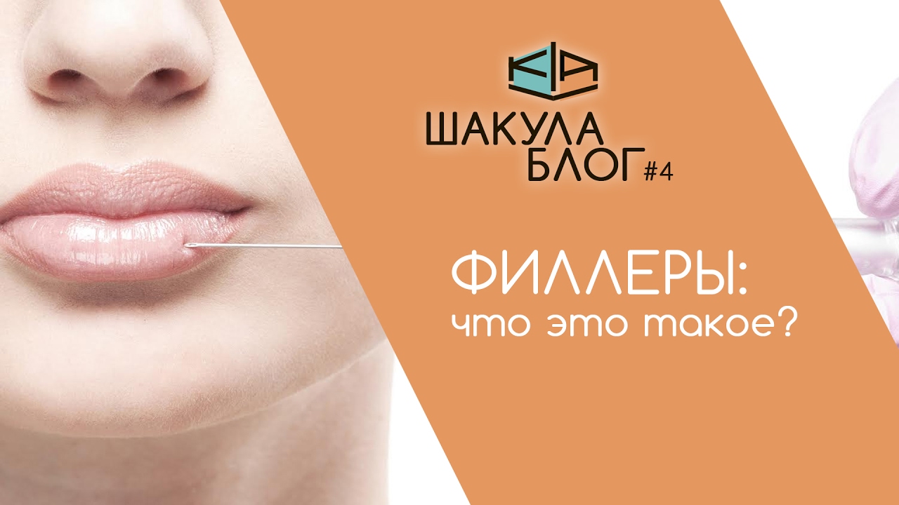 Что такое филлеры? [ШакулаБлог#4]