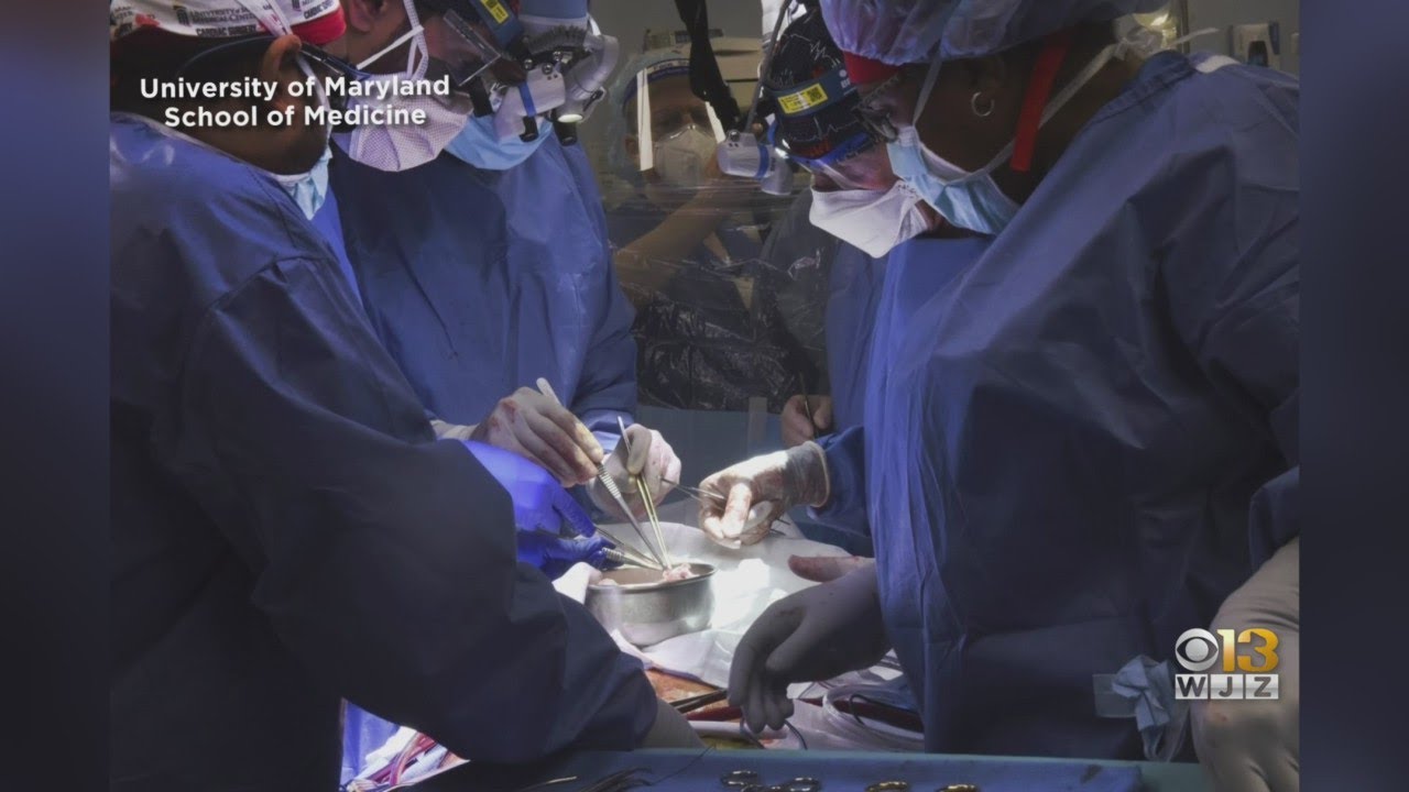 Baltimore Doctors Transplant Pig Heart Into Patient In Experimental, Last-Ditch Effort To Save His L