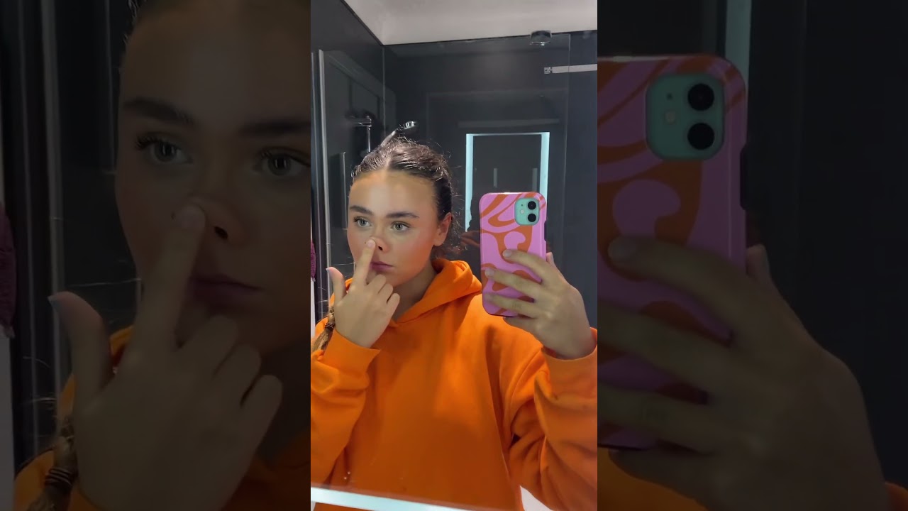 Nose Transformations: Join the Trend 