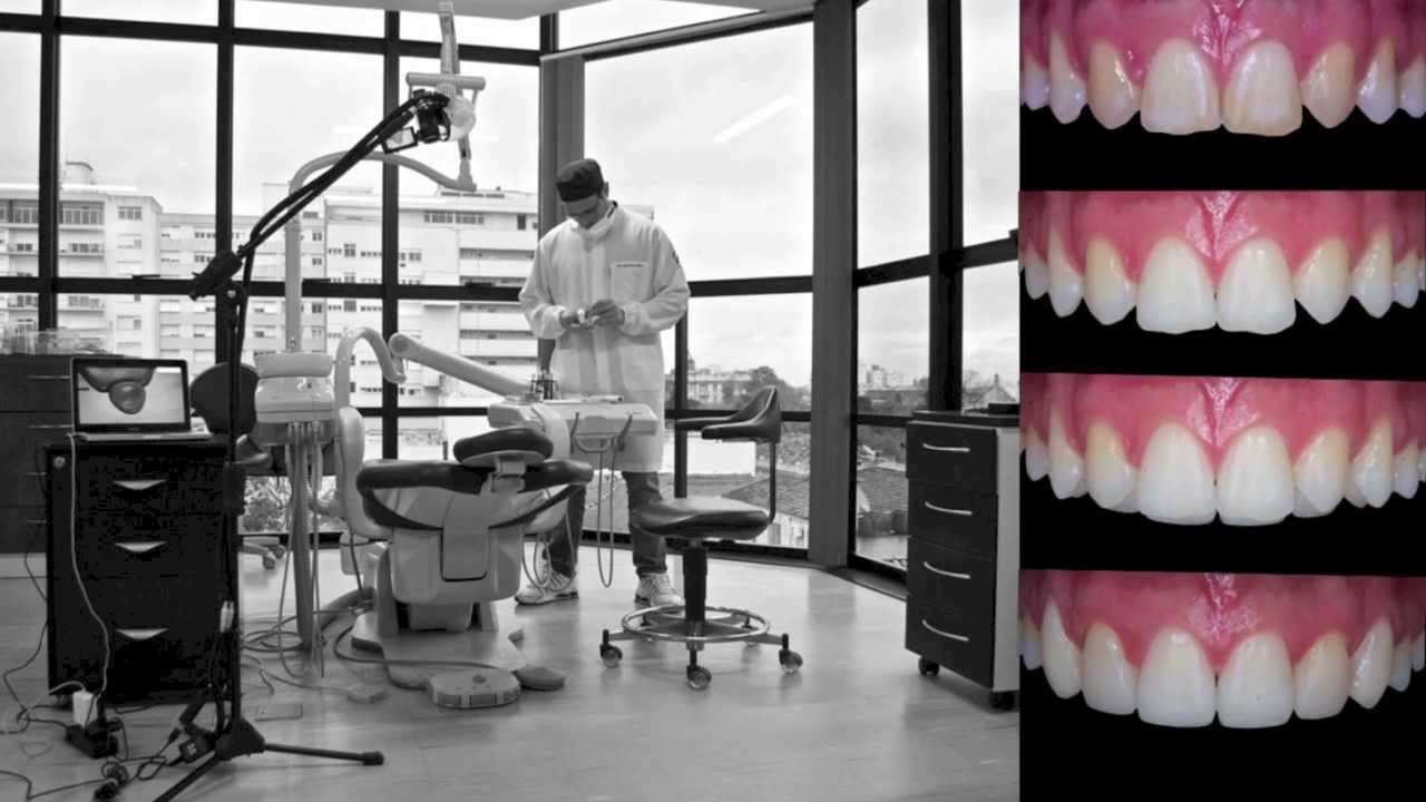 Direct Transformation