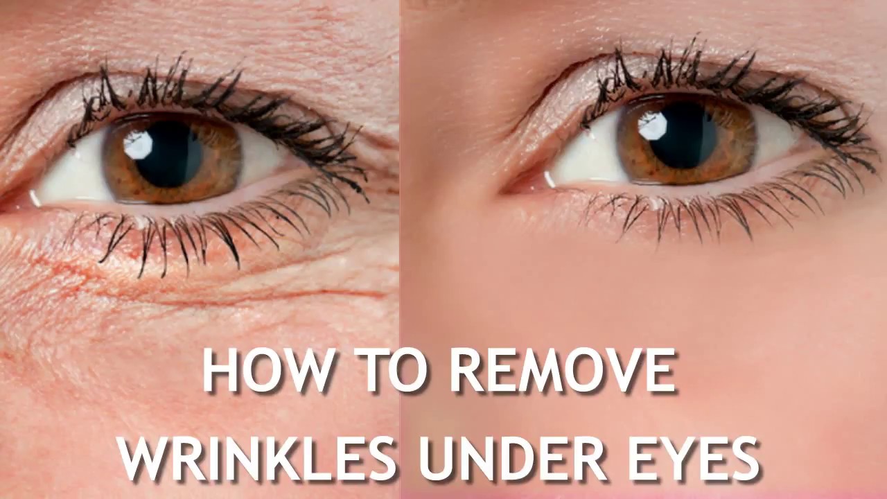How To Remove Wrinkles Under Eyes YouTube