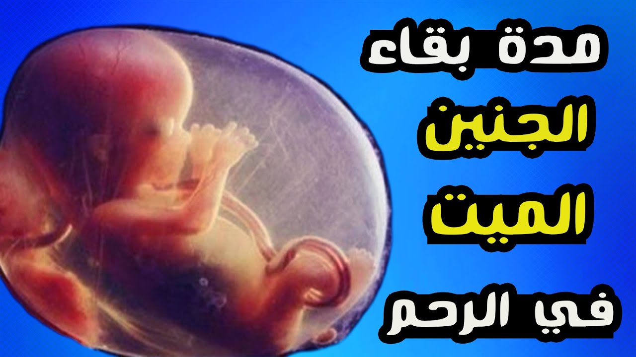 مدة بقاء الجنين الميت في الرحم
