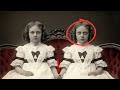 The Twin Who Wasn't Breathing: A 127-Year Secret Hidden in Plain Sight