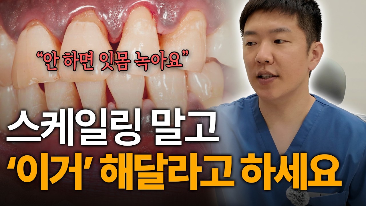 스케일링보다 중요한 '이것!' ㅣ서울대 치과의사가 알려주는 잇몸치료 완벽정리