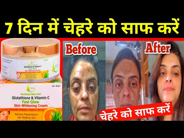 cjc 1295 no dac and ipamorelin dosage CJC-1295 No DAC + Ipamorelin 10mg
