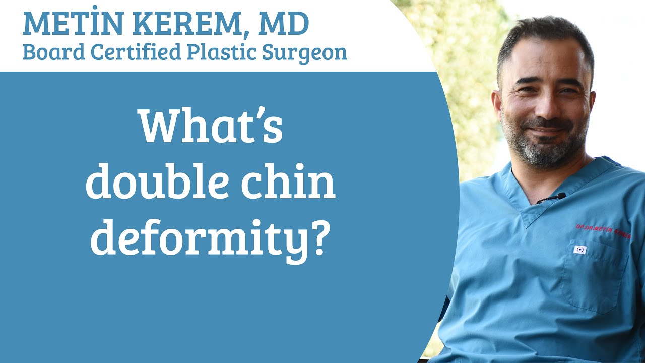 What's double chin deformity?
